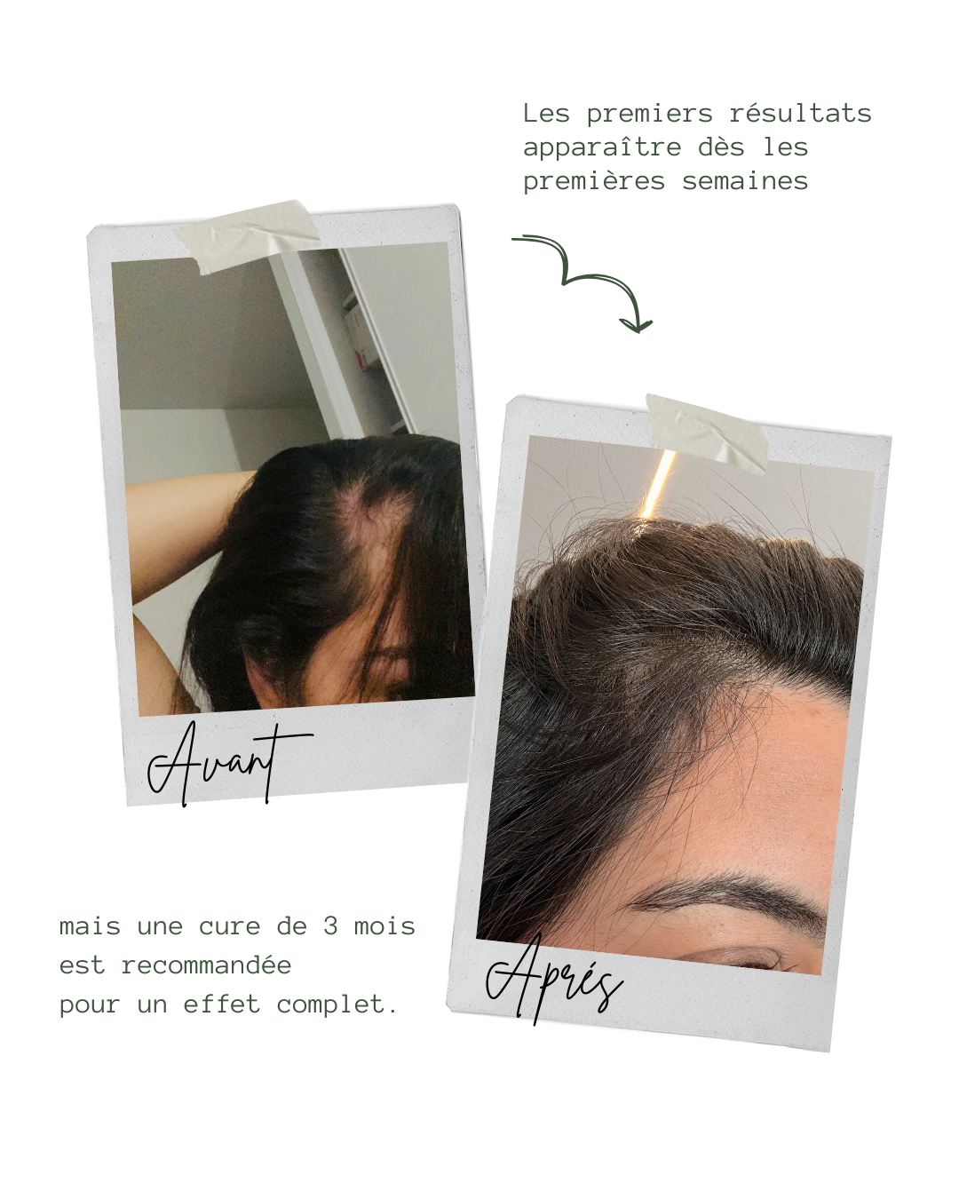 Lotion – Anti-Chute & Pousse intense